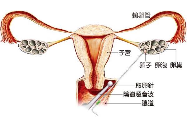 大卫早孕试纸
