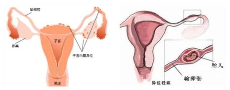 姨妈推迟