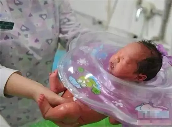 大姨妈血是黑褐色