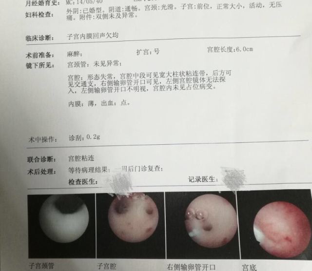 脑发育迟缓