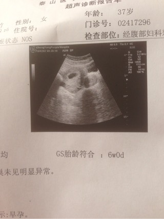 例假不来