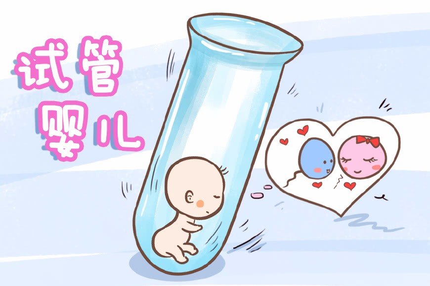 AI绘画