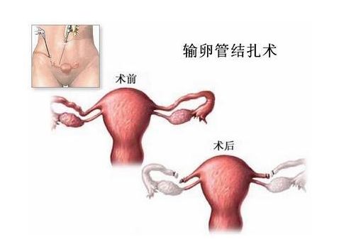 夏天感冒