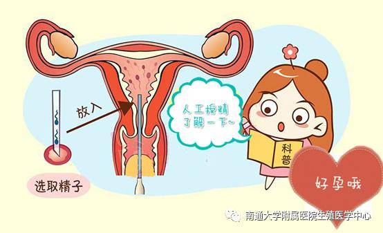 烟台人工授精