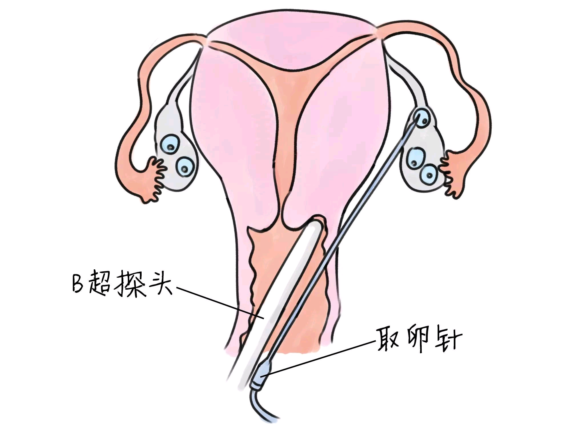 宁波捐卵联系方式