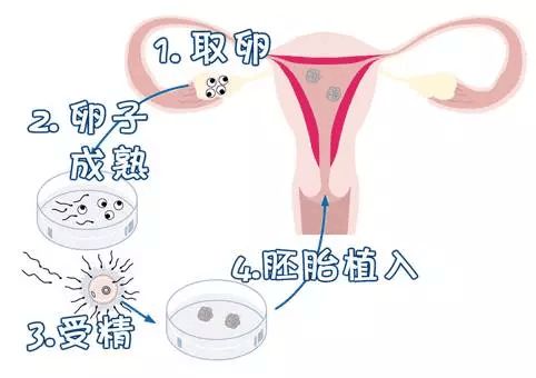 安庆试管代怀孕机构