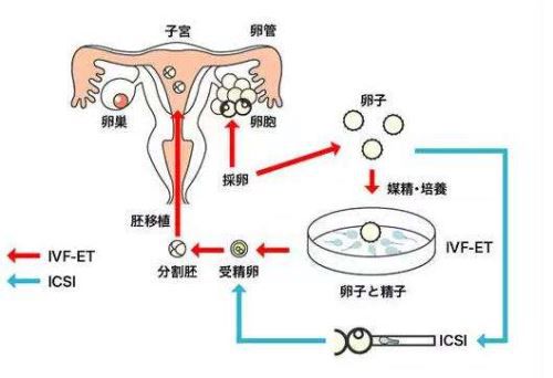 孝感供卵代怀