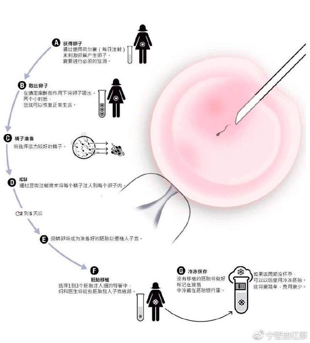 宁波试管代怀孕机构