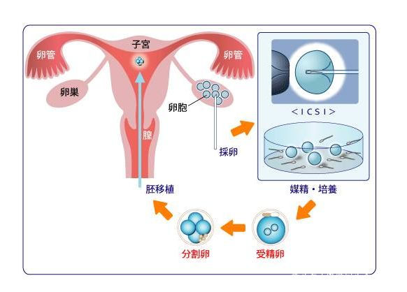 安宁试管代怀孕机构