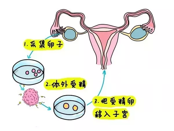 孝感捐卵招聘多少钱